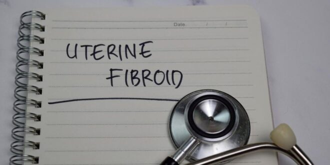 Bagaimana memilih asuransi kesehatan ketika Anda memiliki fibroid